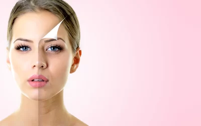 Tot ce trebuie să știți despre tratamentul de lifting Thermage 